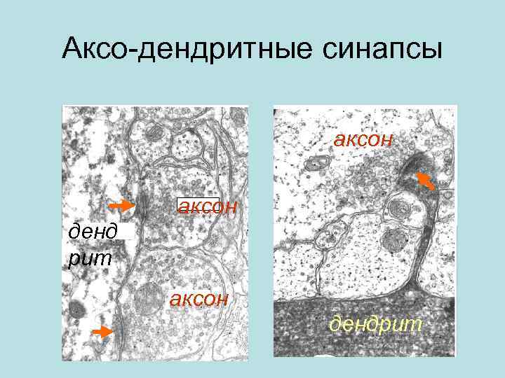 Аксо-дендритные синапсы аксон денд рит аксон дендрит 