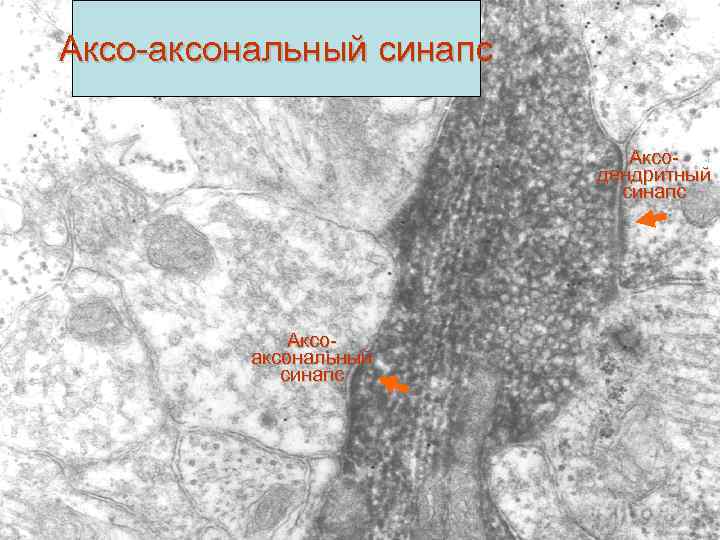 Аксо-аксональный синапс Аксодендритный синапс Аксоаксональный синапс 