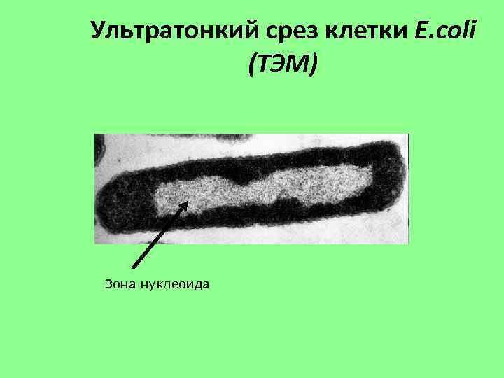 Ультратонкий срез клетки E. coli (ТЭМ) Зона нуклеоида 