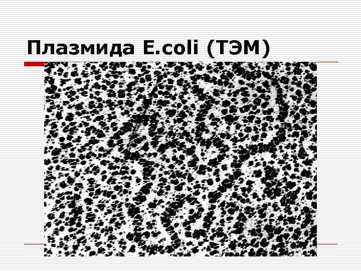 Плазмида E. coli (ТЭМ) 