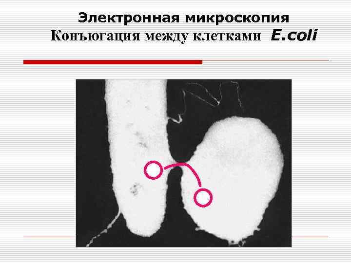 Электронная микроскопия Конъюгация между клетками E. coli 
