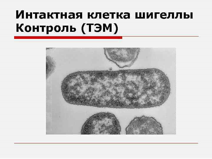 Интактная клетка шигеллы Контроль (ТЭМ) 