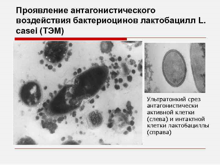 Проявление антагонистического воздействия бактериоцинов лактобацилл L. casei (ТЭМ) Ультратонкий срез антагонистически активной клетки (слева)