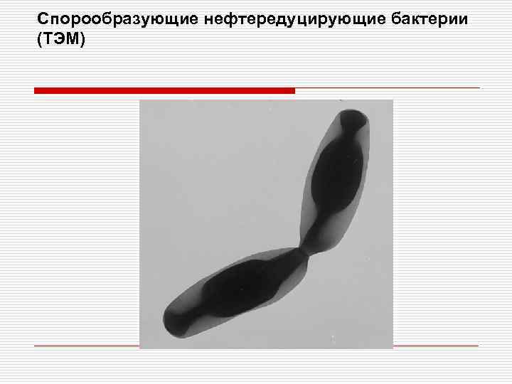 Спорообразующие нефтередуцирующие бактерии (ТЭМ) 