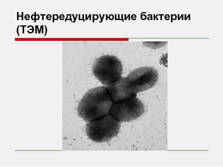 Нефтередуцирующие бактерии (ТЭМ) 