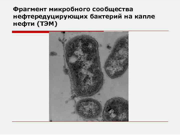 Фрагмент микробного сообщества нефтередуцирующих бактерий на капле нефти (ТЭМ) 