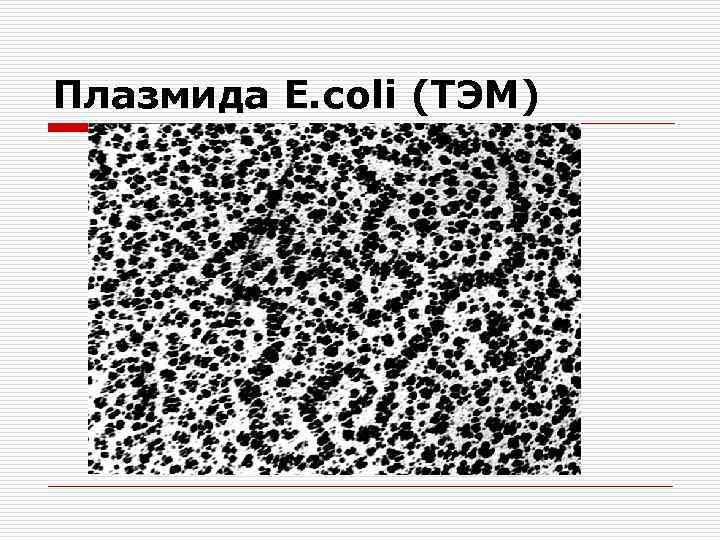 Плазмида E. coli (ТЭМ) 