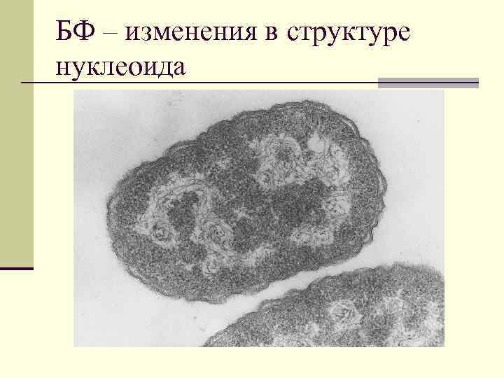 БФ – изменения в структуре нуклеоида 