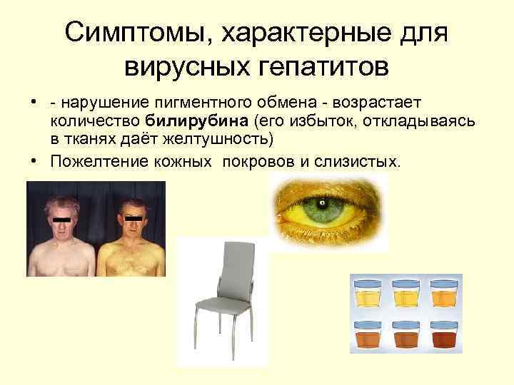 Симптомы, характерные для вирусных гепатитов • - нарушение пигментного обмена - возрастает количество билирубина