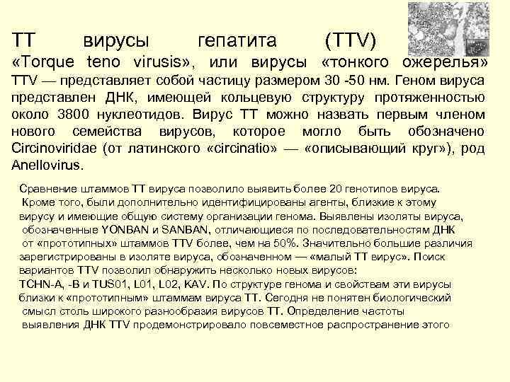 ТТ вирусы гепатита (ТТV) -, «Torque teno virusis» , или вирусы «тонкого ожерелья» ТТV
