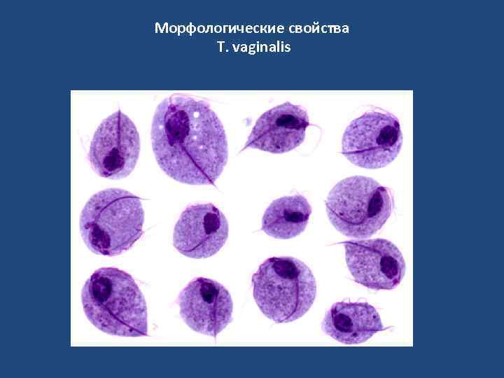 Морфологические свойства T. vaginalis 
