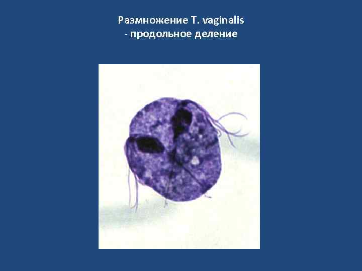 Размножение T. vaginalis - продольное деление 