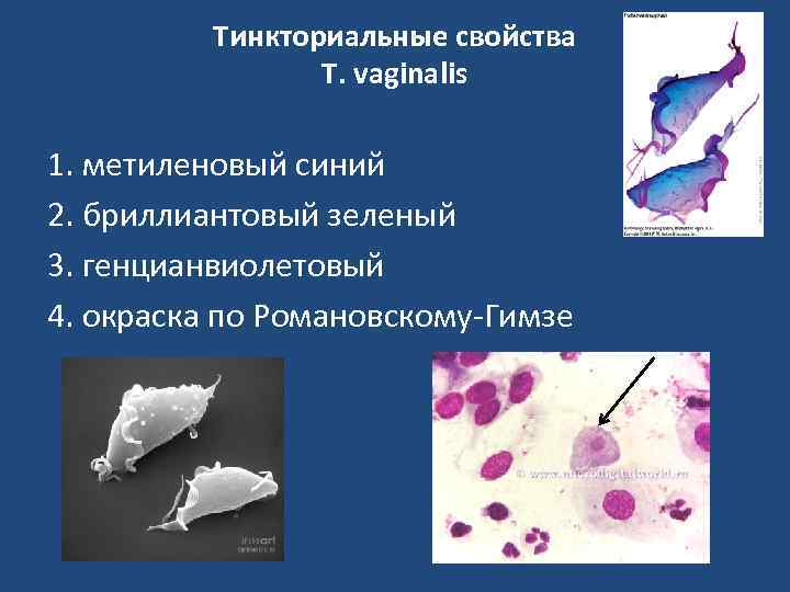 Тинкториальные свойства T. vaginalis 1. метиленовый синий 2. бриллиантовый зеленый 3. генцианвиолетовый 4. окраска