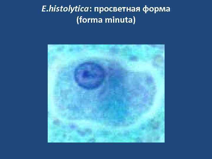 E. histolytica: просветная форма (forma minuta) 