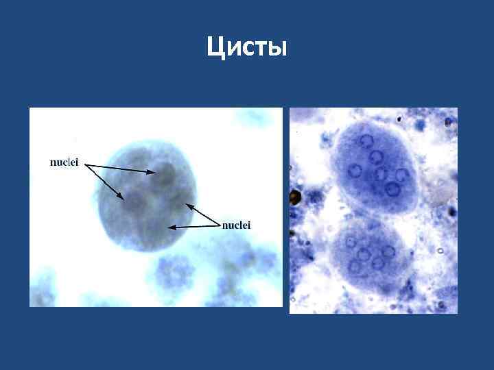 Цисты 