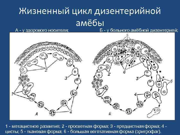 Жизненный цикл дизентерийной амёбы А - у здорового носителя; Б - у больного амёбной