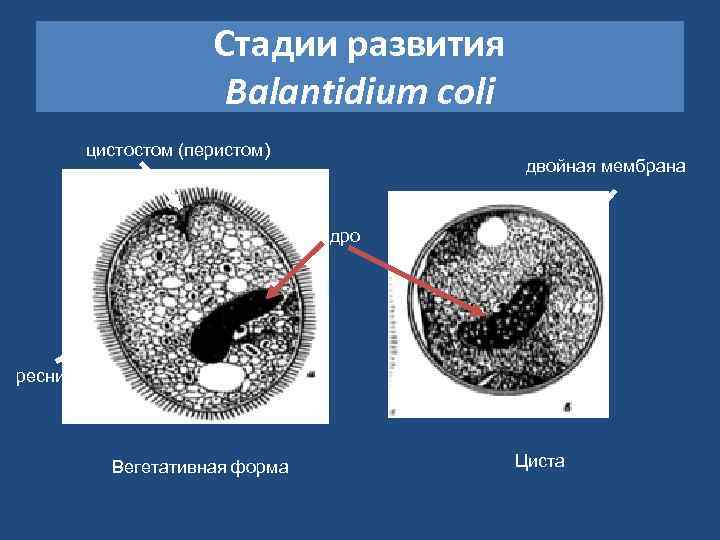 Стадии развития Balantidium coli цистостом (перистом) двойная мембрана ядро реснички Вегетативная форма Циста 