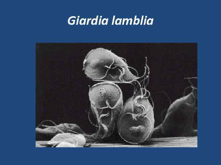 Giardia lamblia 