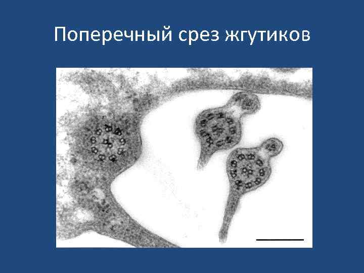 Поперечный срез жгутиков 