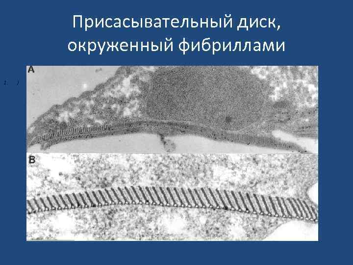 Присасывательный диск, окруженный фибриллами 1. ) 