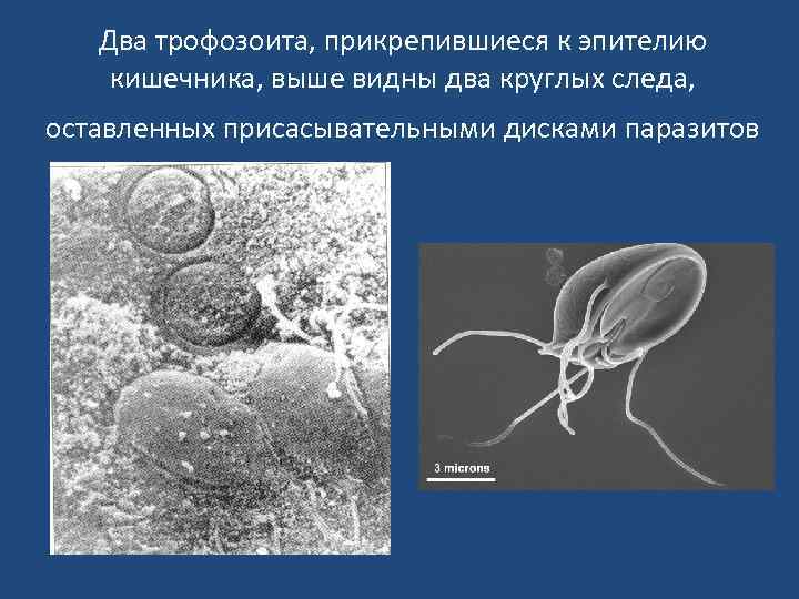 Два трофозоита, прикрепившиеся к эпителию кишечника, выше видны два круглых следа, оставленных присасывательными дисками