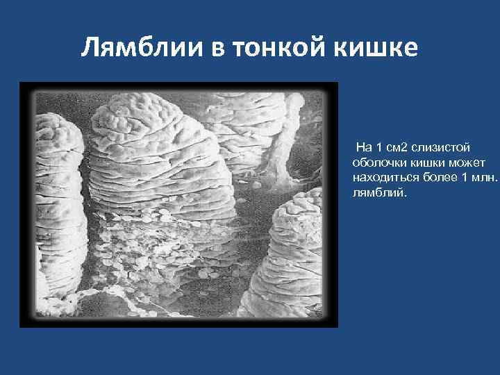 Лямблии в тонкой кишке На 1 см 2 слизистой оболочки кишки может находиться более