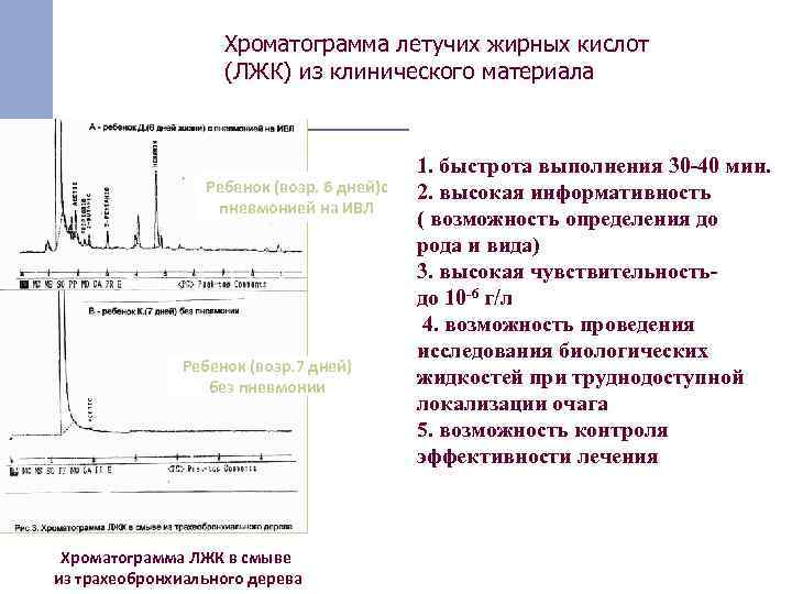 Хроматограмма летучих жирных кислот (ЛЖК) из клинического материала Ребенок (возр. 6 дней)с пневмонией на