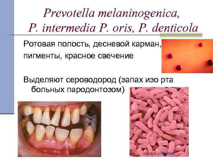 Prevotella melaninogenica, P. intermedia P. oris, P. denticola Ротовая полость, десневой карман, пигменты, красное