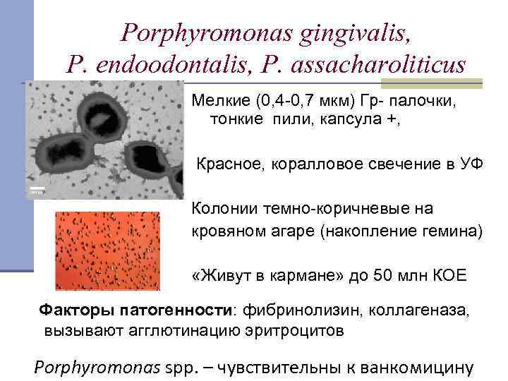 Porphyromonas gingivalis, P. endoodontalis, P. assacharoliticus Мелкие (0, 4 -0, 7 мкм) Гр- палочки,