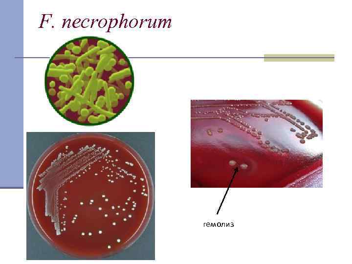 F. necrophorum гемолиз 