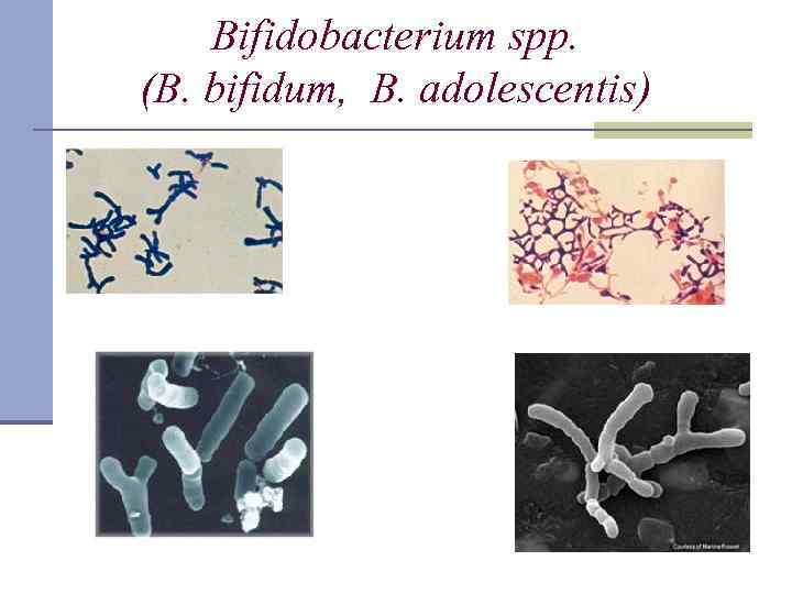 Bifidobacterium spp. (B. bifidum, B. adolescentis) 