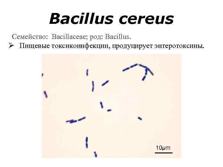 Bacillus cereus Семейство: Bacillaceae; род: Bacillus. Ø Пищевые токсикоинфекции, продуцирует энтеротоксины. 