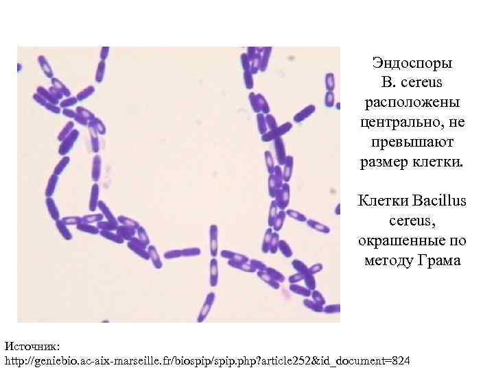 Эндоспоры B. cereus расположены центрально, не превышают размер клетки. Клетки Bacillus cereus, окрашенные по