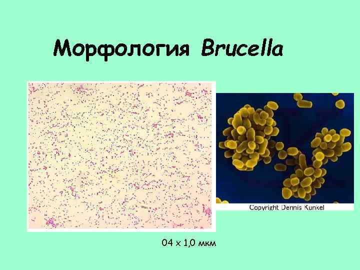 Морфология Brucella 04 х 1, 0 мкм 