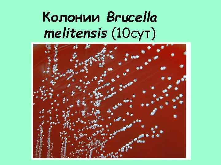 Колонии Brucella melitensis (10 сут) 
