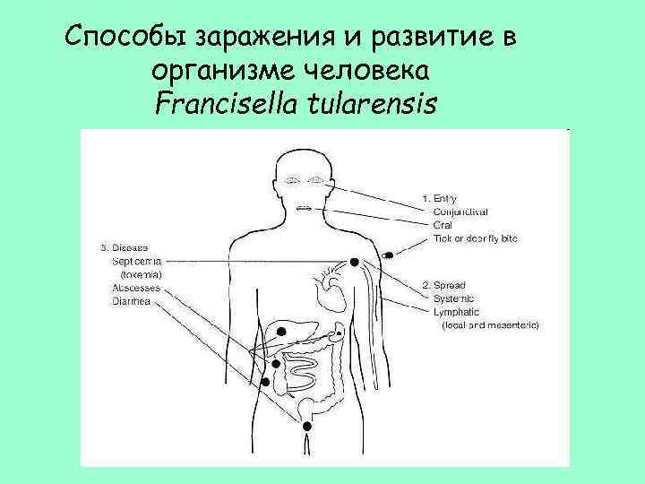 Способы заражения и развитие в организме человека Francisella tularensis 