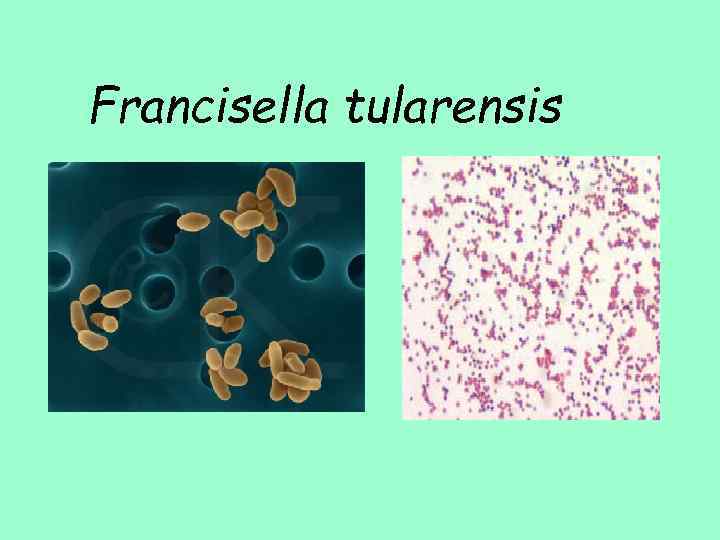 Francisella tularensis 
