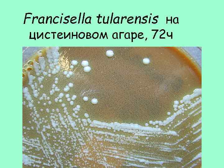Francisella tularensis на цистеиновом агаре, 72 ч 