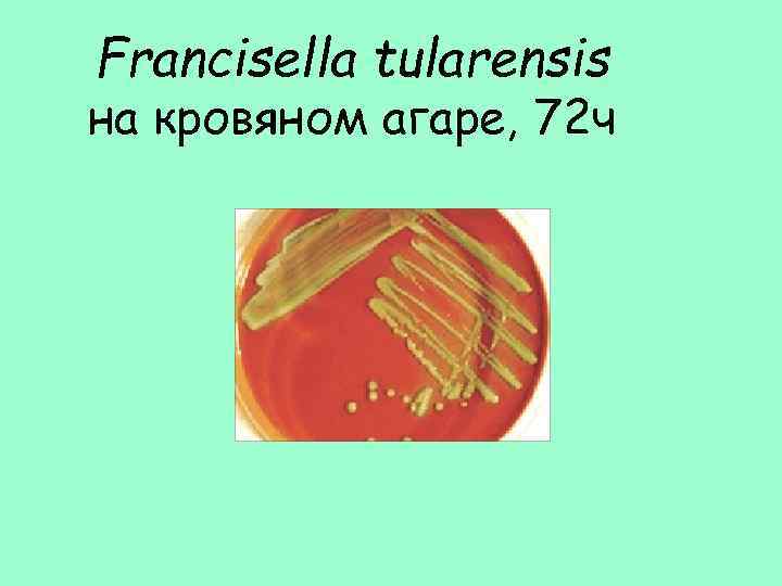 Francisella tularensis на кровяном агаре, 72 ч 