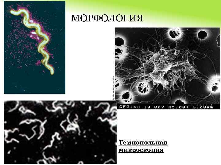 МОРФОЛОГИЯ Темнопольная микроскопия 