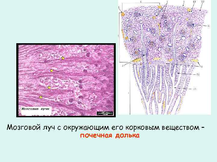 Мозговой луч с окружающим его корковым веществом – почечная долька 