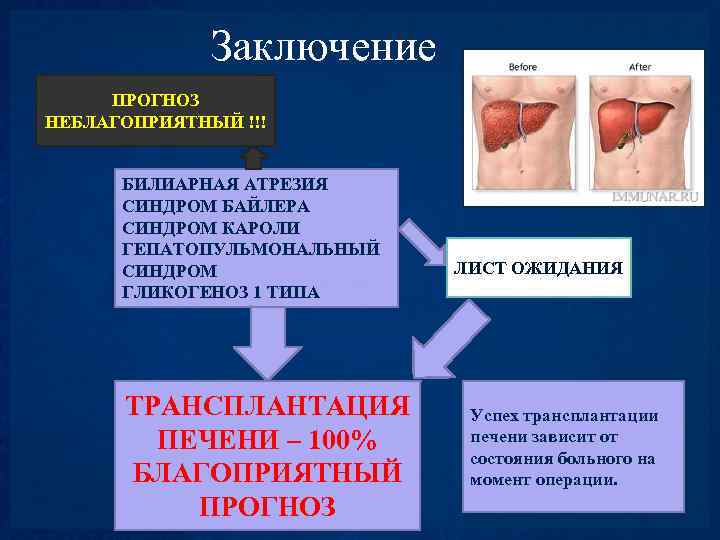 Заключение ПРОГНОЗ НЕБЛАГОПРИЯТНЫЙ !!! БИЛИАРНАЯ АТРЕЗИЯ СИНДРОМ БАЙЛЕРА СИНДРОМ КАРОЛИ ГЕПАТОПУЛЬМОНАЛЬНЫЙ СИНДРОМ ГЛИКОГЕНОЗ 1