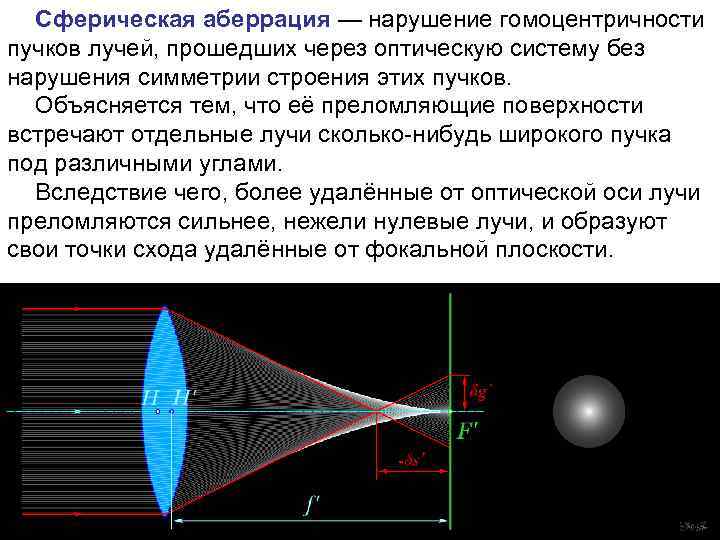 Явление сферической аберрации способствует созданию четкого изображения на сетчатке