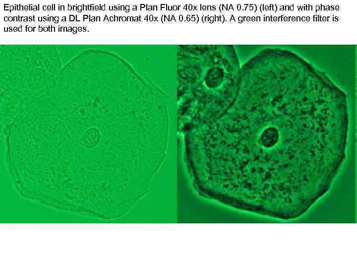 Epithelial cell in brightfield using a Plan Fluor 40 x lens (NA 0. 75)