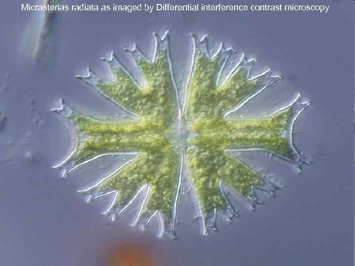 Micrasterias radiata as imaged by Differential interference contrast microscopy 