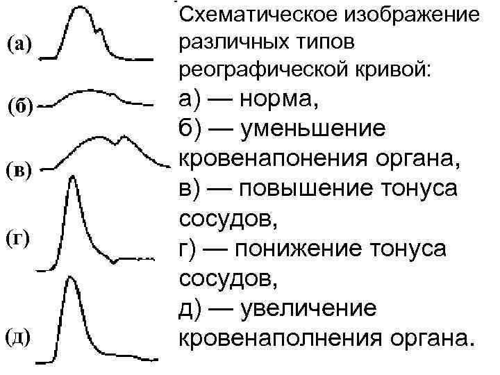 Тонус график