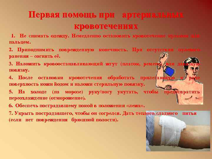 Первая помощь при артериальных кровотечениях 1. Не снимать одежду. Немедленно остановить кровотечение кулаком или