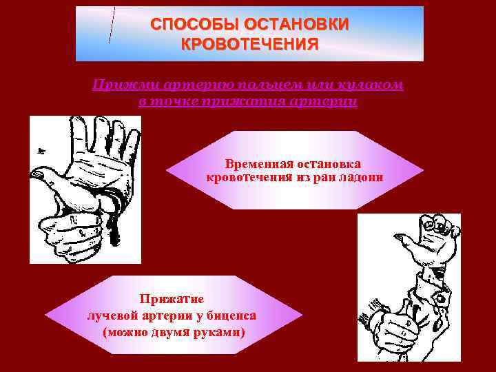 СПОСОБЫ ОСТАНОВКИ КРОВОТЕЧЕНИЯ Прижми артерию пальцем или кулаком в точке прижатия артерии Временная остановка