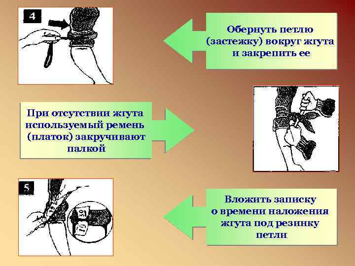 Обернуть петлю (застежку) вокруг жгута и закрепить ее При отсутствии жгута используемый ремень (платок)