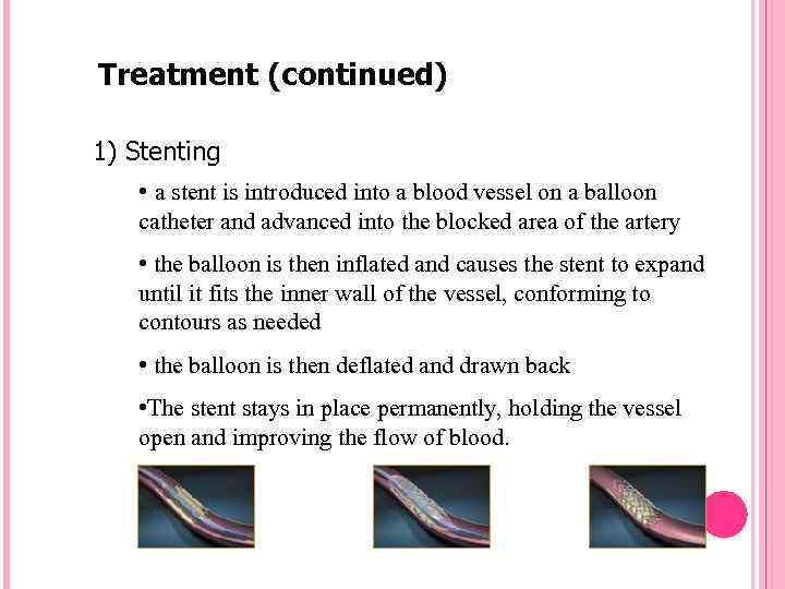 Treatment (continued) 1) Stenting • a stent is introduced into a blood vessel on